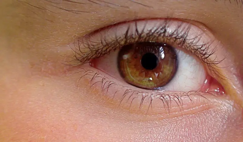 Plastyka powiek górnych